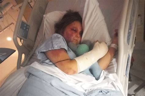 kirra hart news|Kirra Harts story — Her brutal attack explained